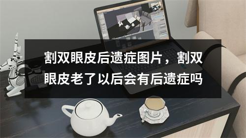 割双眼皮后遗症图片，割双眼皮老了以后会有后遗症吗