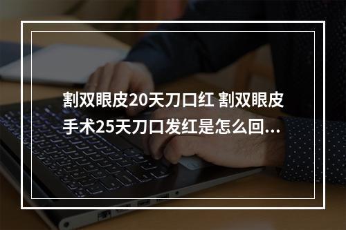 割双眼皮20天刀口红 割双眼皮手术25天刀口发红是怎么回事