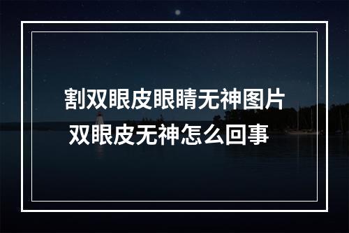 割双眼皮眼睛无神图片 双眼皮无神怎么回事