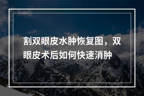 割双眼皮水肿恢复图，双眼皮术后如何快速消肿