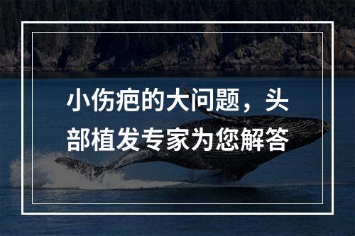 小伤疤的大问题，头部植发专家为您解答