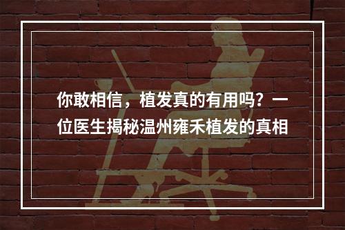 你敢相信，植发真的有用吗？一位医生揭秘温州雍禾植发的真相