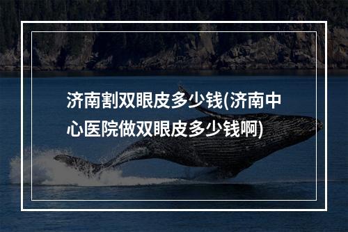 济南割双眼皮多少钱(济南中心医院做双眼皮多少钱啊)