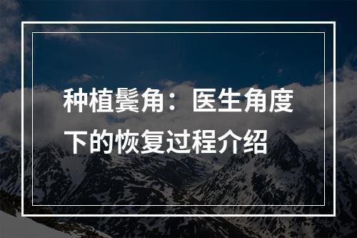 种植鬓角：医生角度下的恢复过程介绍