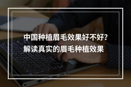 中国种植眉毛效果好不好？解读真实的眉毛种植效果