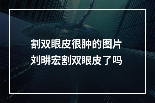 割双眼皮很肿的图片 刘畊宏割双眼皮了吗