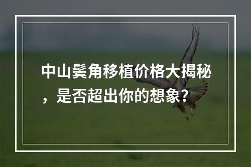 中山鬓角移植价格大揭秘，是否超出你的想象？