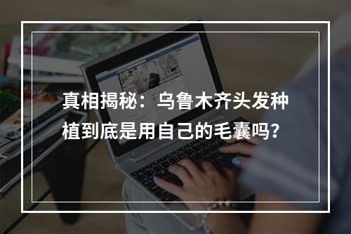 真相揭秘：乌鲁木齐头发种植到底是用自己的毛囊吗？