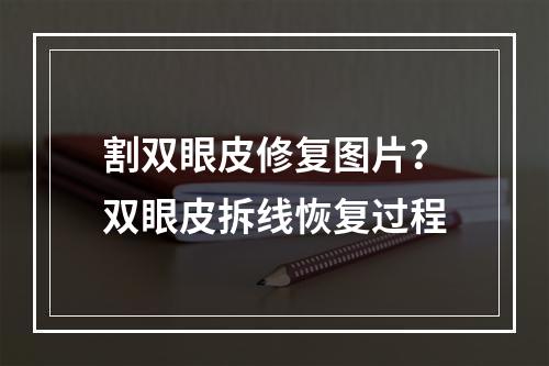 割双眼皮修复图片？双眼皮拆线恢复过程