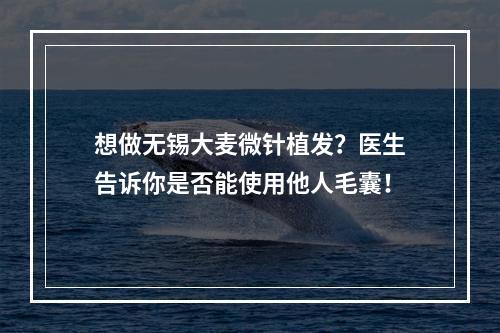 想做无锡大麦微针植发？医生告诉你是否能使用他人毛囊！