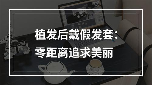 植发后戴假发套：零距离追求美丽