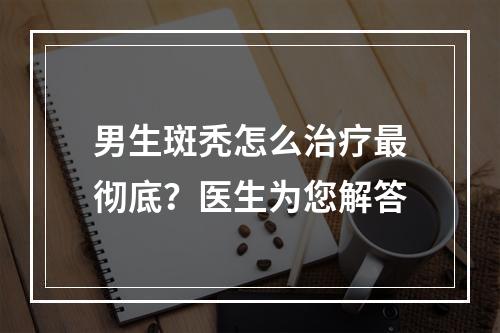 男生斑秃怎么治疗最彻底？医生为您解答