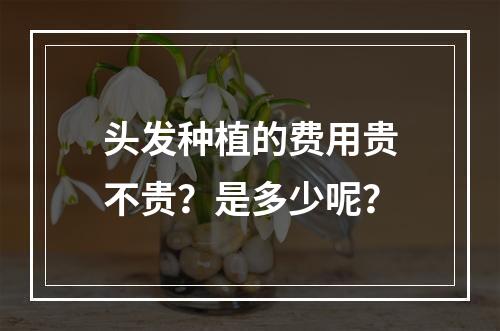 头发种植的费用贵不贵？是多少呢？