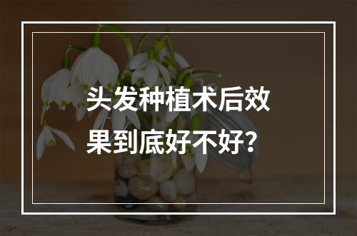 头发种植术后效果到底好不好？