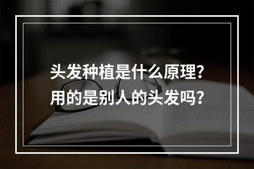 头发种植是什么原理？用的是别人的头发吗？