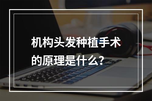 机构头发种植手术的原理是什么？