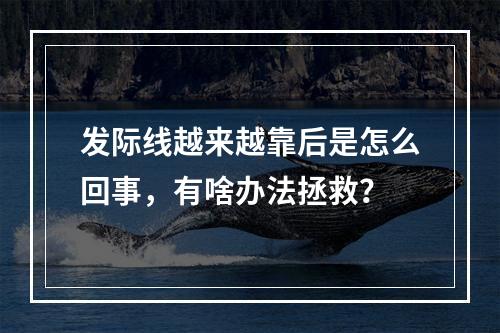 发际线越来越靠后是怎么回事，有啥办法拯救？