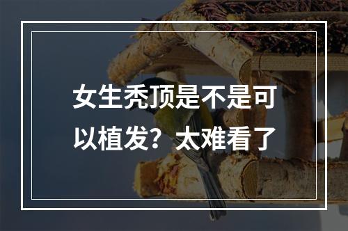 女生秃顶是不是可以植发？太难看了