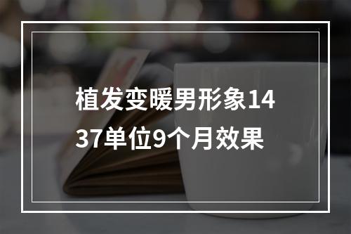 植发变暖男形象1437单位9个月效果