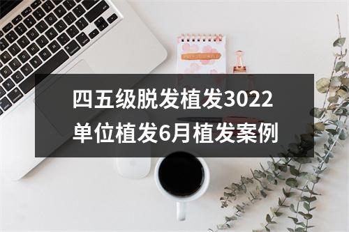 四五级脱发植发3022单位植发6月植发案例