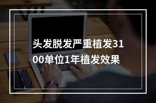 头发脱发严重植发3100单位1年植发效果