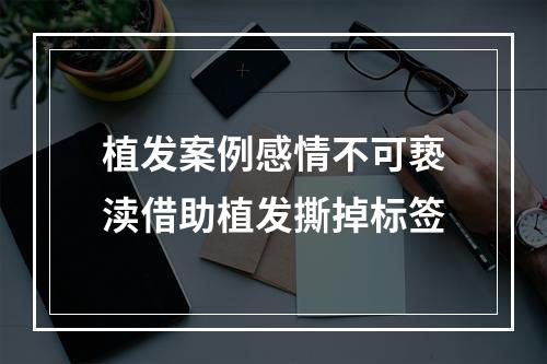 植发案例感情不可亵渎借助植发撕掉标签