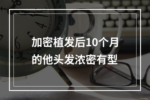 加密植发后10个月的他头发浓密有型