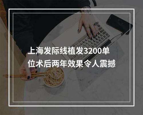 上海发际线植发3200单位术后两年效果令人震撼