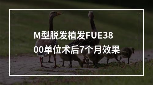 M型脱发植发FUE3800单位术后7个月效果