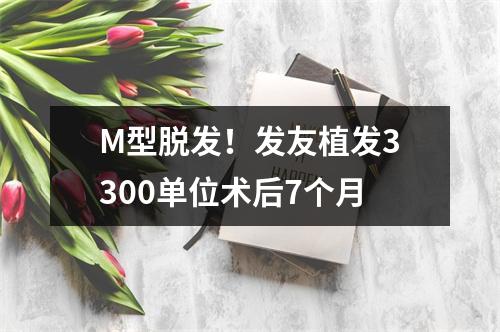 M型脱发！发友植发3300单位术后7个月