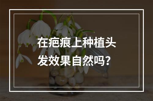 在疤痕上种植头发效果自然吗？