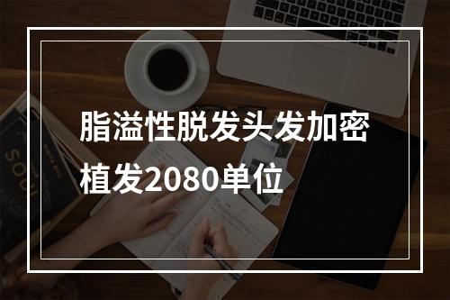 脂溢性脱发头发加密植发2080单位