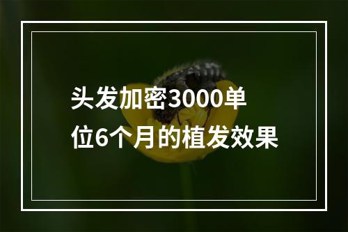 头发加密3000单位6个月的植发效果