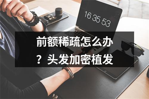 前额稀疏怎么办？头发加密植发