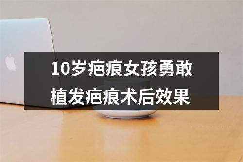 10岁疤痕女孩勇敢植发疤痕术后效果