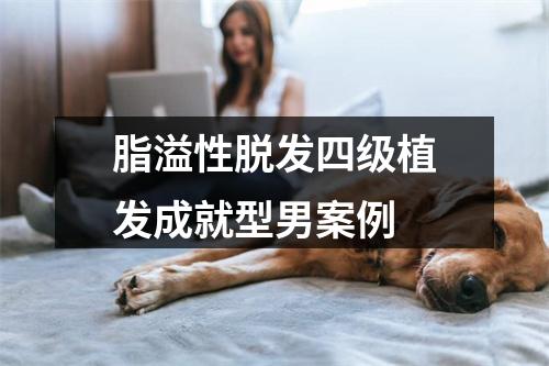 脂溢性脱发四级植发成就型男案例