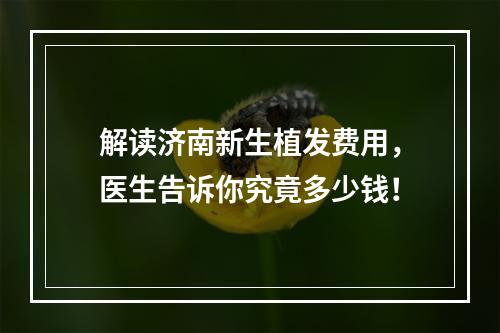 解读济南新生植发费用，医生告诉你究竟多少钱！