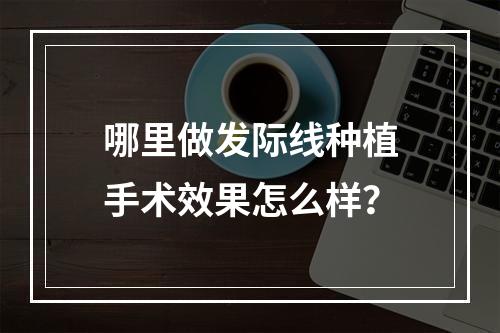 哪里做发际线种植手术效果怎么样？