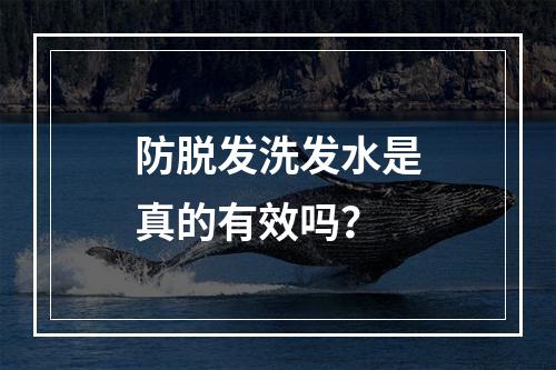 防脱发洗发水是真的有效吗？