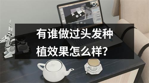 有谁做过头发种植效果怎么样？