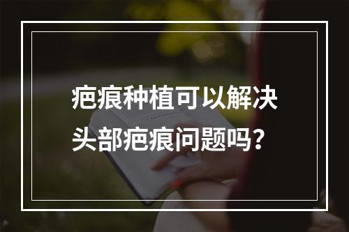 疤痕种植可以解决头部疤痕问题吗？