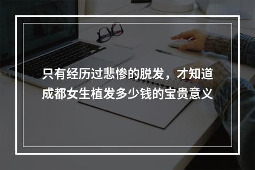 只有经历过悲惨的脱发，才知道成都女生植发多少钱的宝贵意义