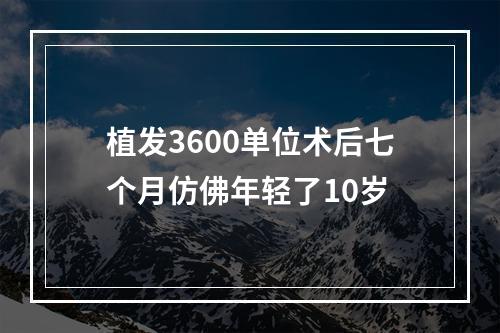 植发3600单位术后七个月仿佛年轻了10岁