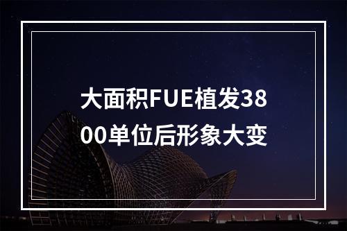 大面积FUE植发3800单位后形象大变