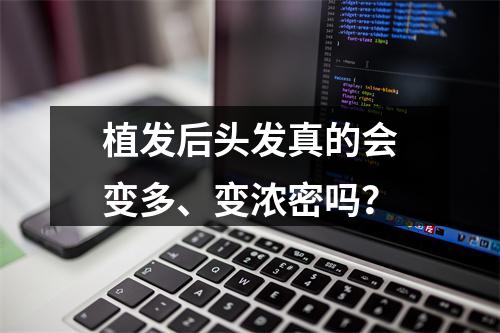 植发后头发真的会变多、变浓密吗？