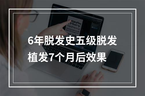 6年脱发史五级脱发植发7个月后效果