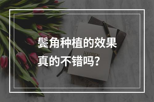 鬓角种植的效果真的不错吗？