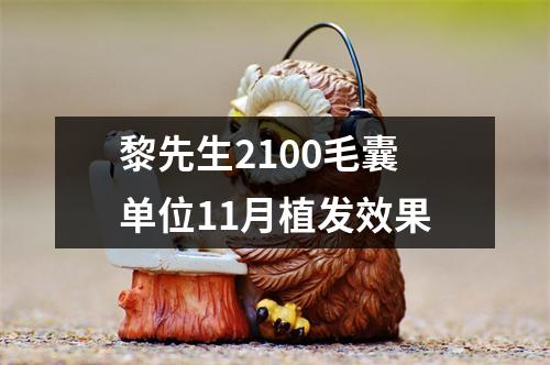 黎先生2100毛囊单位11月植发效果