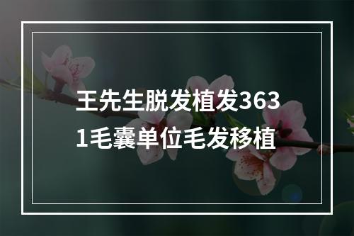 王先生脱发植发3631毛囊单位毛发移植