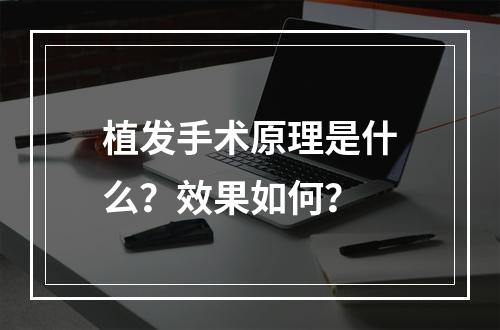 植发手术原理是什么？效果如何？